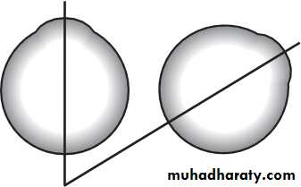 Lectures of Ophthalmology