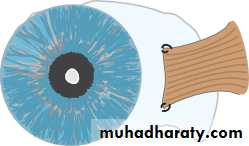 Lectures of Ophthalmology