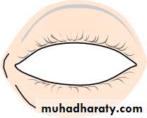 Lectures of Ophthalmology