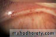 Lectures of Ophthalmology