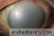 Lectures of Ophthalmology