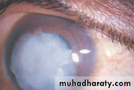 Lectures of Ophthalmology