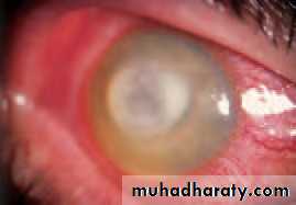 Lectures of Ophthalmology