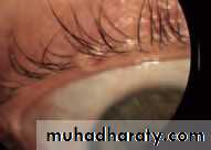Lectures of Ophthalmology