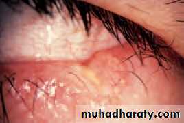 Lectures of Ophthalmology