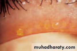 Lectures of Ophthalmology