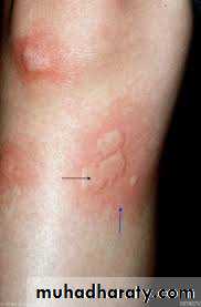 Morphology of The Skin