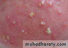 Morphology of The Skin