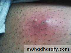 Morphology of The Skin