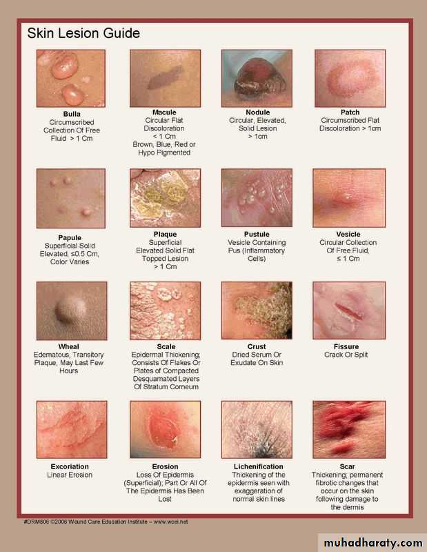 Morphology of The Skin
