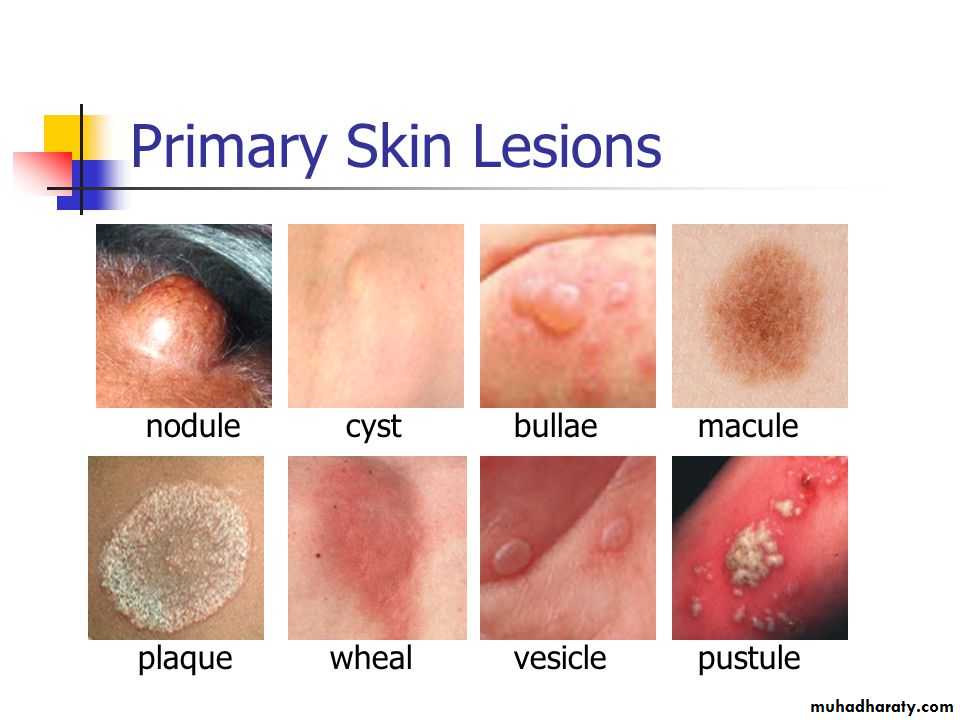Morphology of The Skin