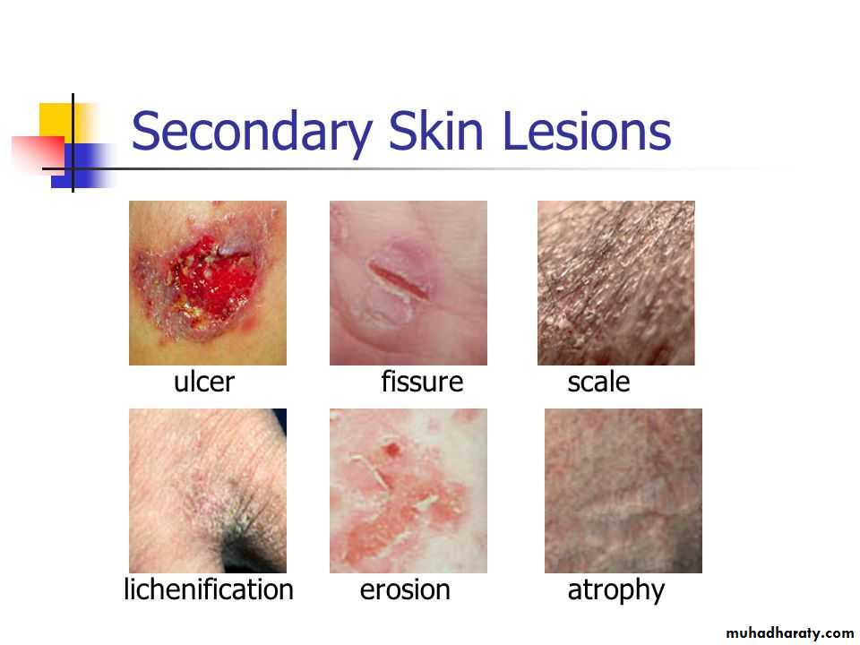 Morphology of The Skin