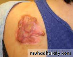 Morphology of The Skin