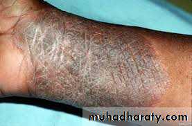 Morphology of The Skin