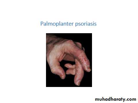 Papulosequamous disorders
