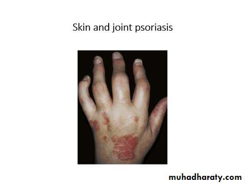 Papulosequamous disorders