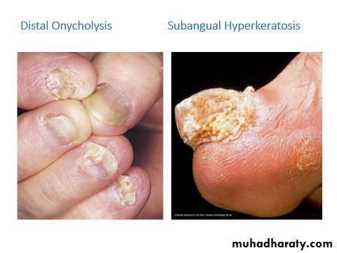 Papulosequamous disorders
