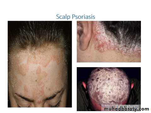 Papulosequamous disorders