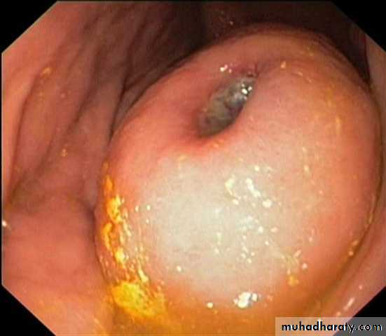 stomach and duodenum