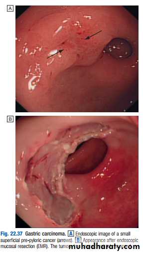 stomach and duodenum