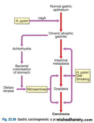 stomach and duodenum