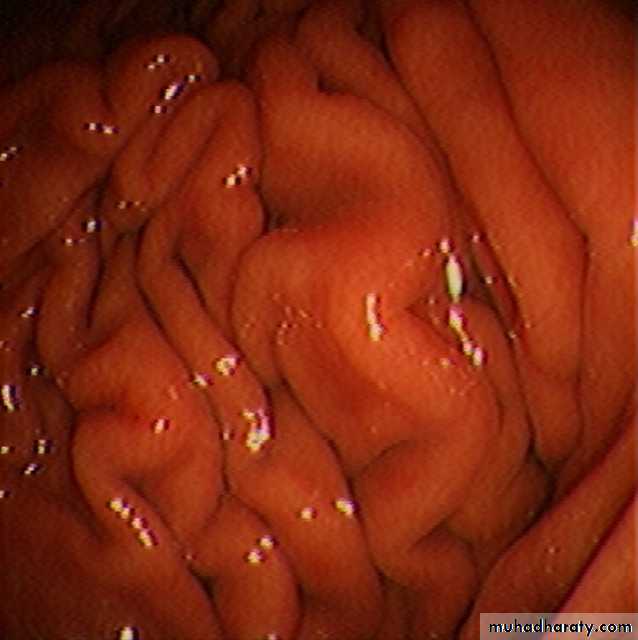 stomach and duodenum(datashow)1