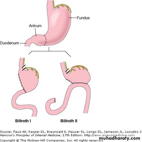 stomach and duodenum(datashow)1