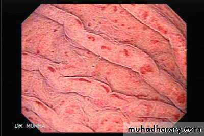 stomach and duodenum(datashow)1