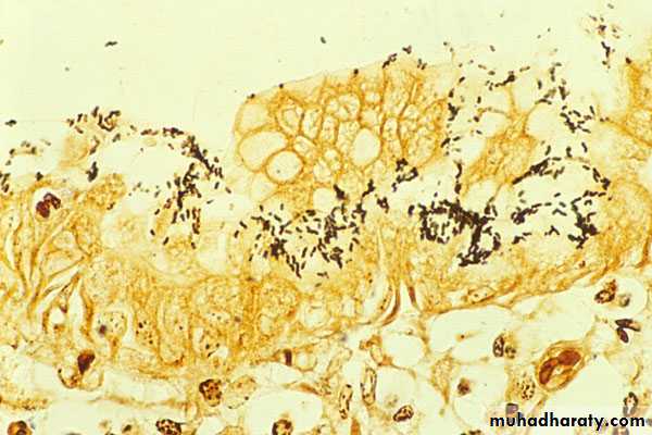 stomach and duodenum(datashow)1