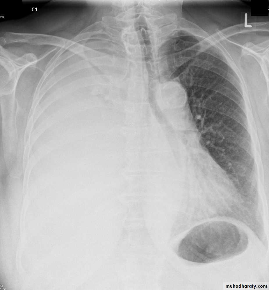 Chest Imaging