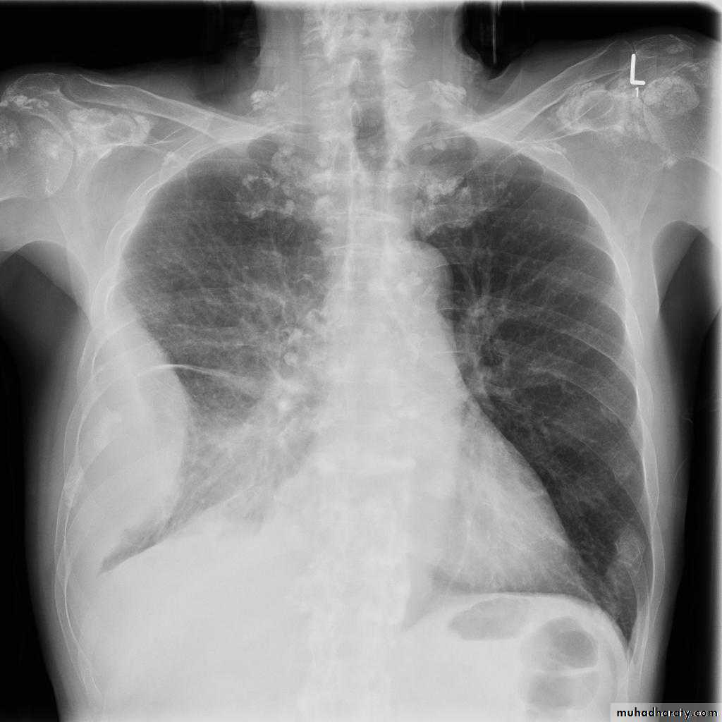 Chest Imaging
