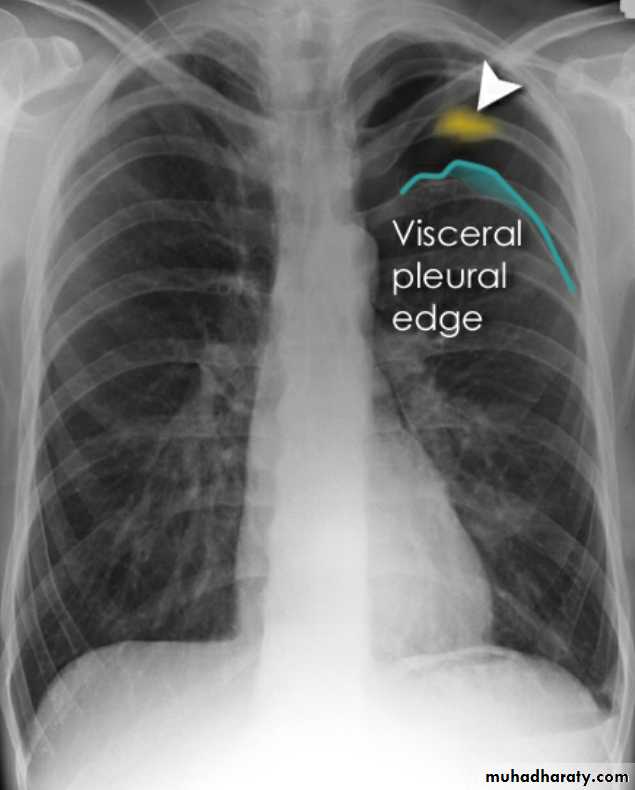 Chest Imaging