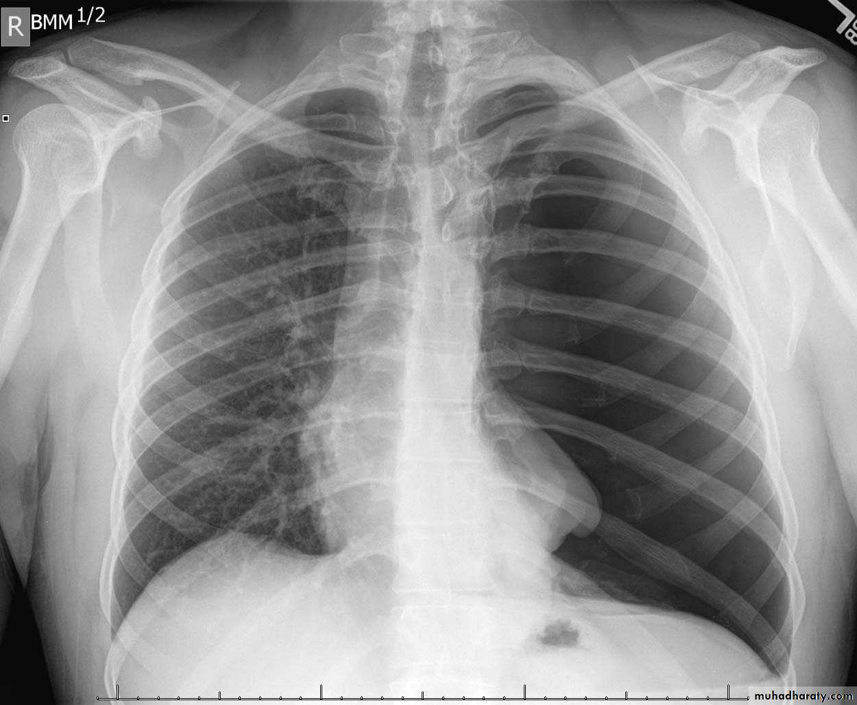 Chest Imaging