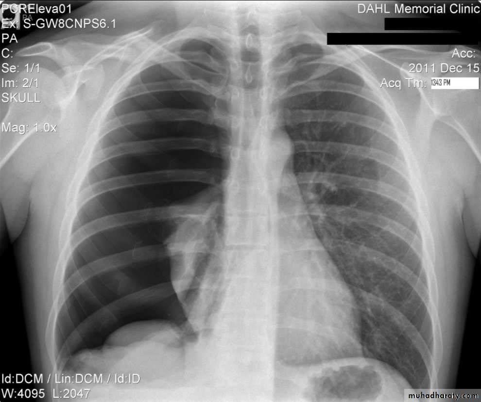 Chest Imaging
