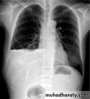 Chest Imaging