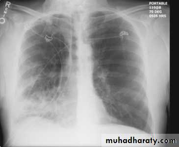 Chest Imaging