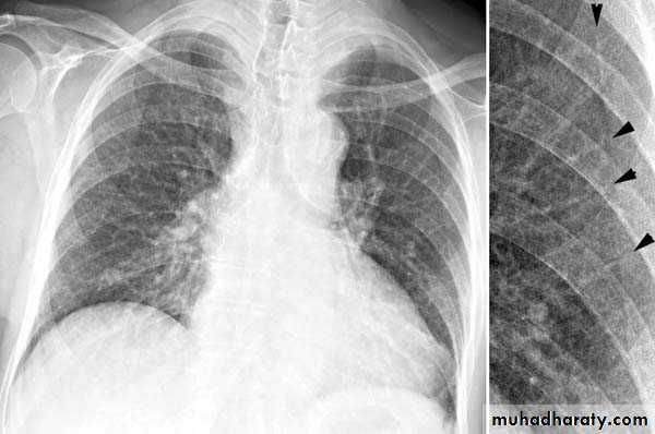 Chest Imaging