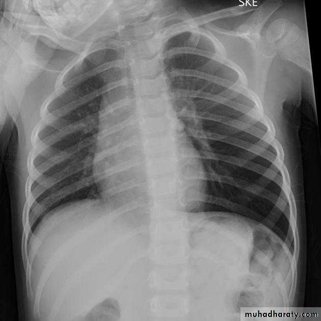 Chest Imaging