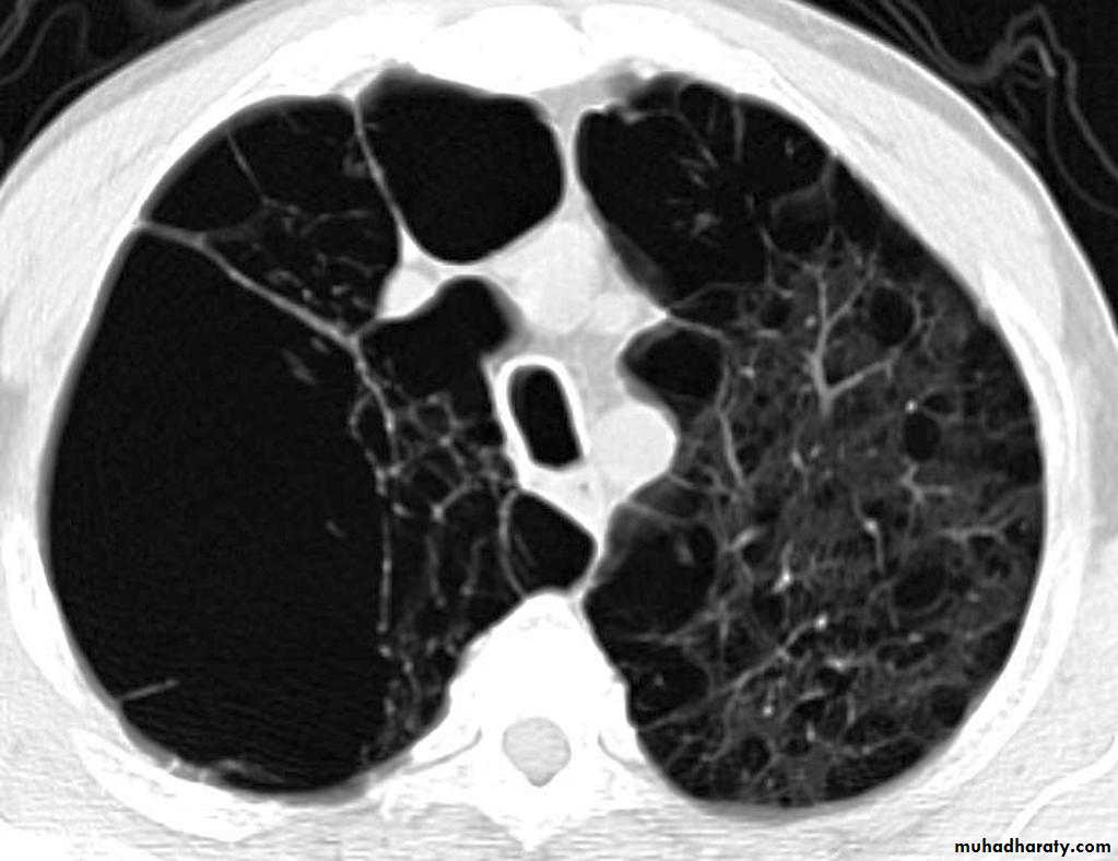 Chest Imaging