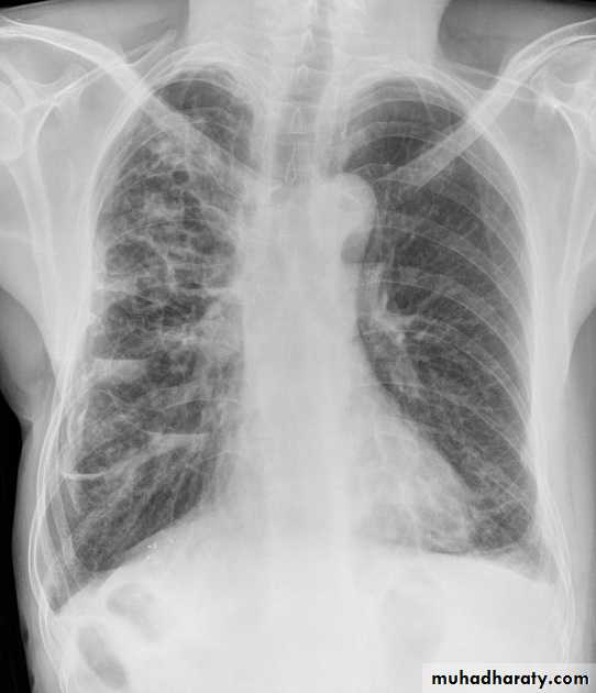 Chest Imaging