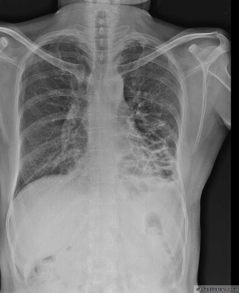 Chest Imaging