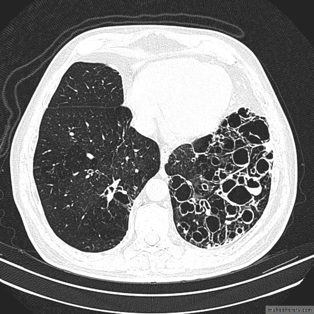 Chest Imaging