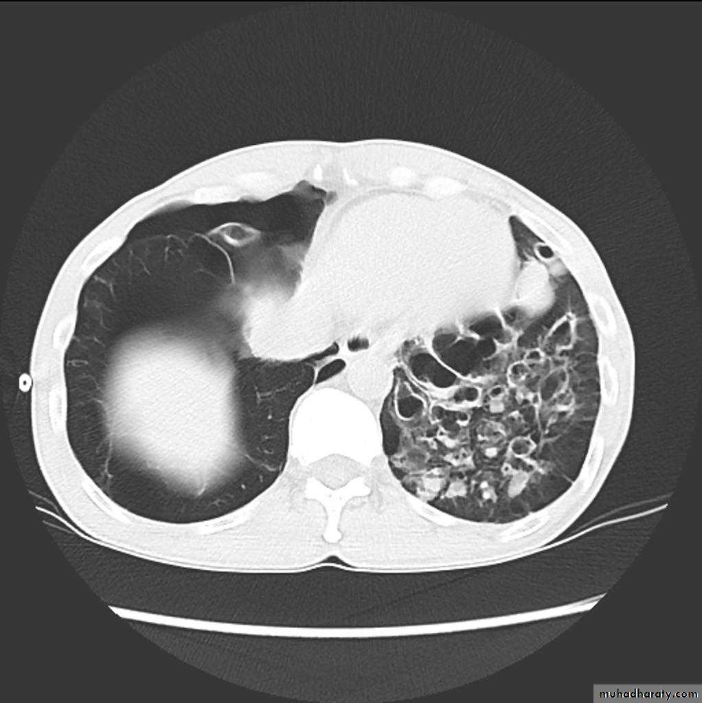 Chest Imaging