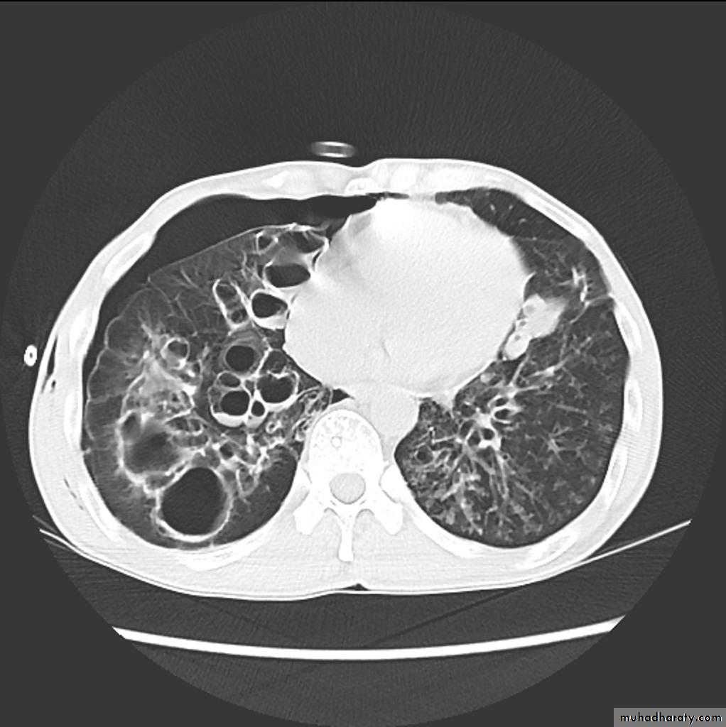 Chest Imaging