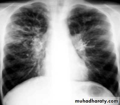 Chest Imaging