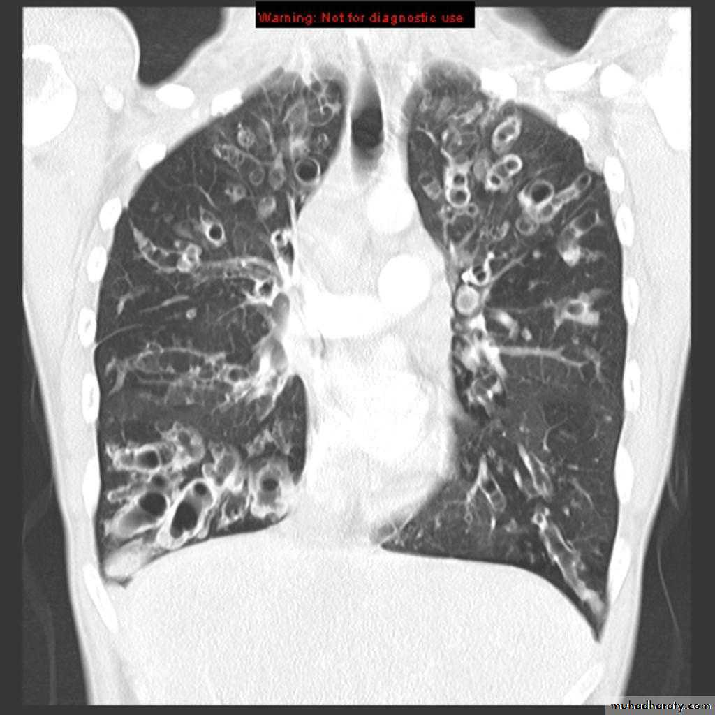 Chest Imaging