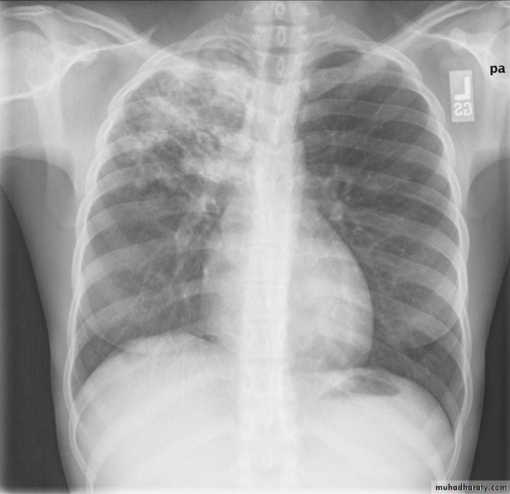 Chest Imaging