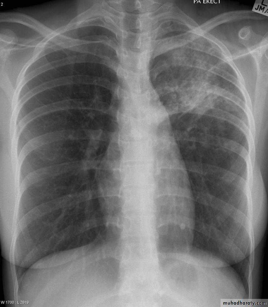 Chest Imaging