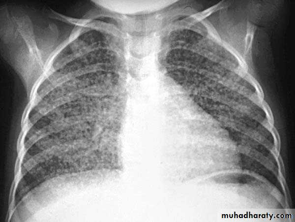 Chest Imaging