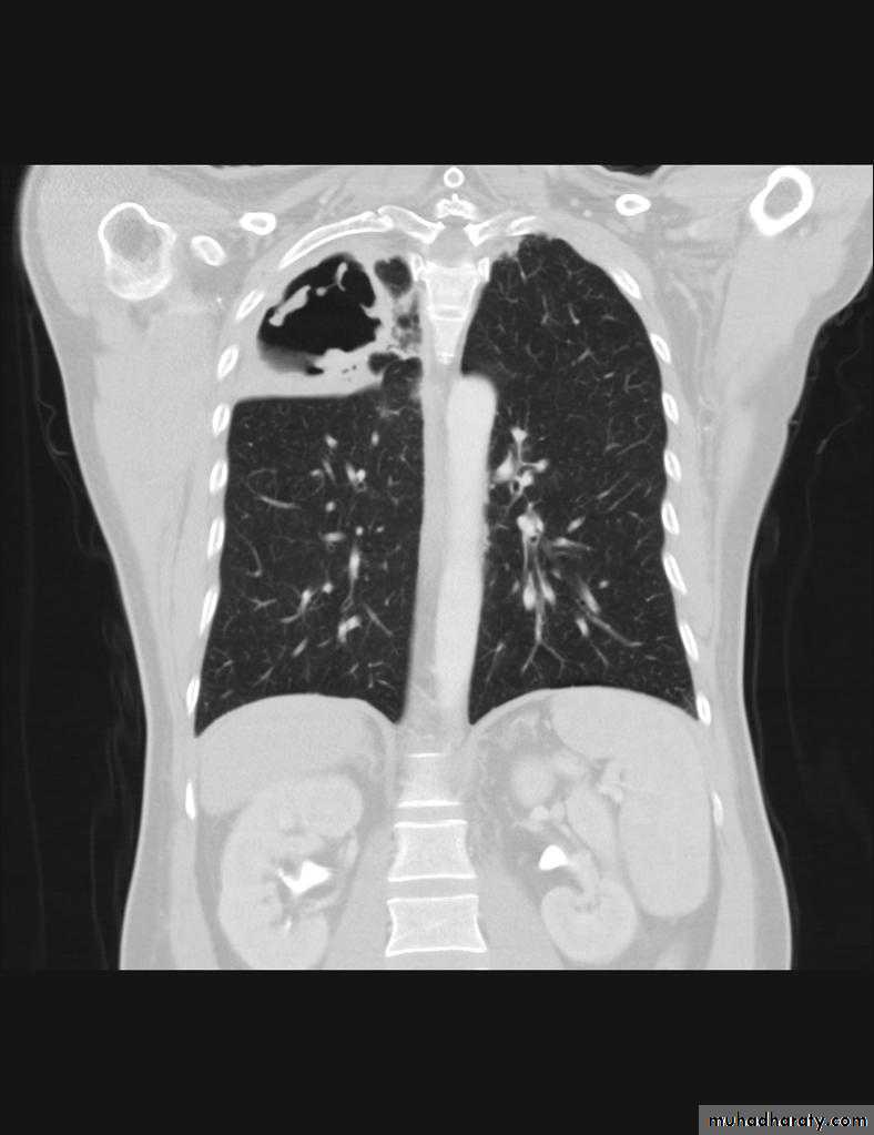 Chest Imaging